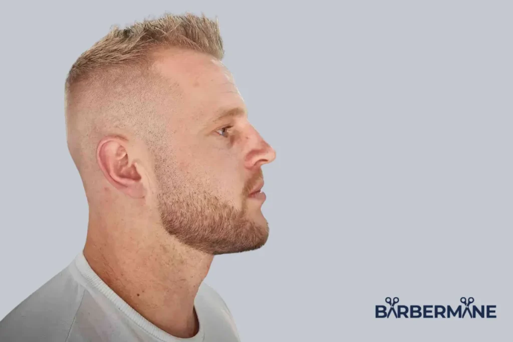 Ivy-League-for-Thinning-Hair